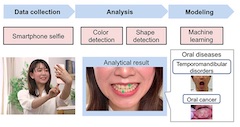 Tohoku University and DOCOMO Launch Research Project to Develop Artificial-intelligence Technology for Periodontal Disease Detection